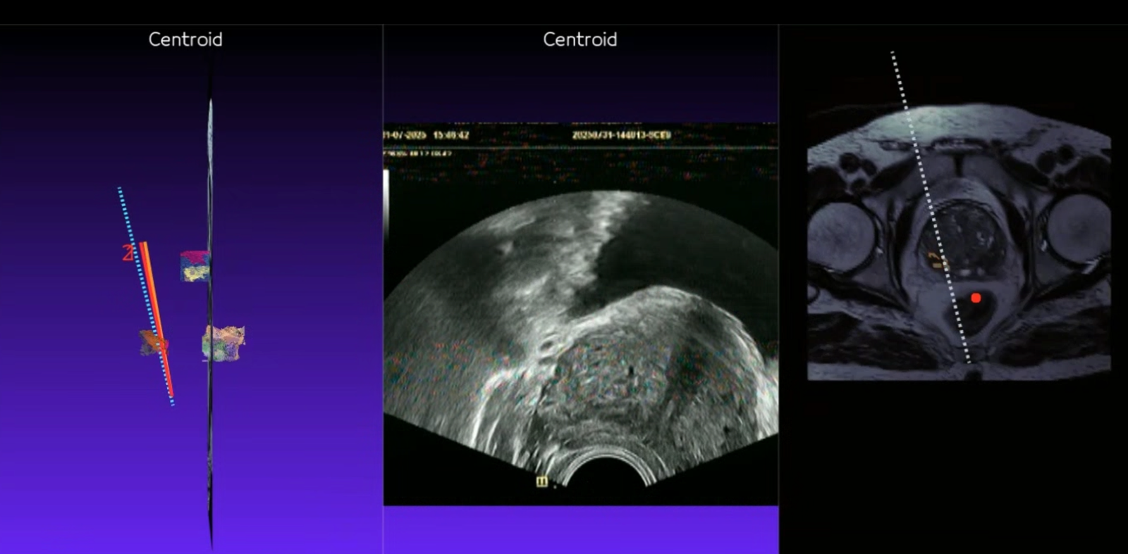 Prostat MR Görüntüleme